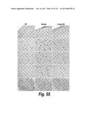 CNS DELIVERY OF THERAPEUTIC AGENTS diagram and image