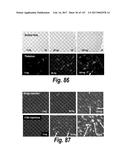 CNS DELIVERY OF THERAPEUTIC AGENTS diagram and image