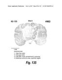 CNS DELIVERY OF THERAPEUTIC AGENTS diagram and image