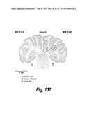 CNS DELIVERY OF THERAPEUTIC AGENTS diagram and image