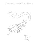 Anchoring System For A Medical Article diagram and image