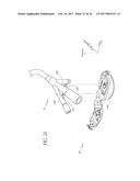 Anchoring System For A Medical Article diagram and image