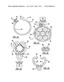 Smart Material Actuated Fasteners diagram and image