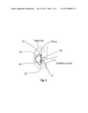 Sound System with Ear Device with Improved Fit and Sound diagram and image