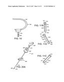 MINIMALLY INVASIVE SURGICAL ASSEMBLY AND METHODS diagram and image