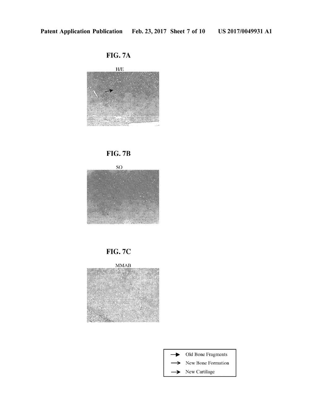 Biocompatible Scaffolds with Tissue Fragments - diagram, schematic, and image 08