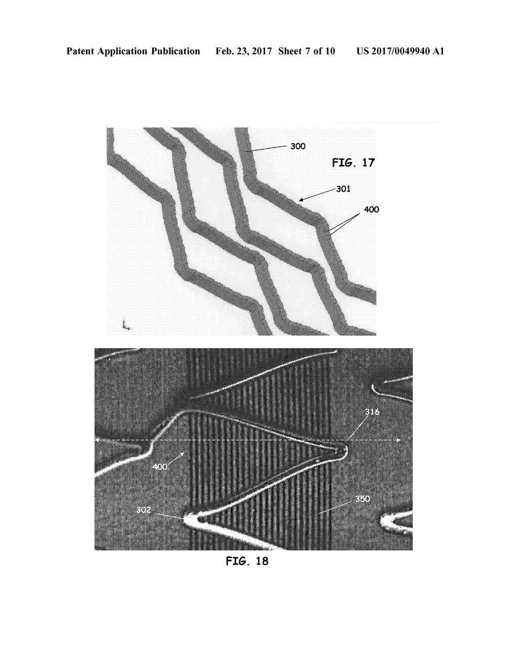 PATTERN TRANSFER DEVICE FOR MASS TRANSFER OF MICRO-PATTERNS ONTO MEDICAL     DEVICES - diagram, schematic, and image 08