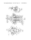 MECHANICAL LOCK FOR A WORK SUPPORT diagram and image