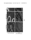 ANTIGEN DETECTION USING PHOTOCLEAVABLE LABELS diagram and image