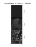 ANTIGEN DETECTION USING PHOTOCLEAVABLE LABELS diagram and image