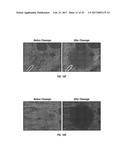 ANTIGEN DETECTION USING PHOTOCLEAVABLE LABELS diagram and image