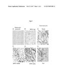 BIOMARKERS AND METHODS OF TREATING PD-1 AND PD-L1 RELATED CONDITIONS diagram and image