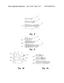 SIZE-ADJUSTABLE PROTECTING AND IMMOBILIZING SLEEVES FOR MRI DEVICES diagram and image