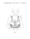 BREAST PROTECTIVE GARMENT diagram and image