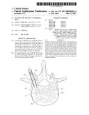 SYSTEMS FOR TREATING A VERTEBRAL BODY diagram and image