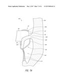 REPLACEMENT HEART VALVES AND METHODS OF DELIVERY diagram and image