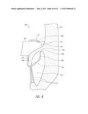 REPLACEMENT HEART VALVES AND METHODS OF DELIVERY diagram and image