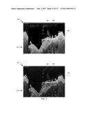 MULTICHANNEL SONAR SYSTEMS AND METHODS diagram and image