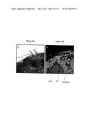 METHOD FOR ANALYZING BIOLOGICAL SPECIMENS BY SPECTRAL IMAGING diagram and image