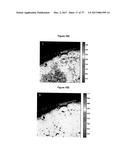 METHOD FOR ANALYZING BIOLOGICAL SPECIMENS BY SPECTRAL IMAGING diagram and image