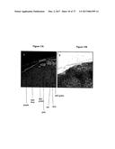 METHOD FOR ANALYZING BIOLOGICAL SPECIMENS BY SPECTRAL IMAGING diagram and image