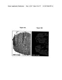 METHOD FOR ANALYZING BIOLOGICAL SPECIMENS BY SPECTRAL IMAGING diagram and image