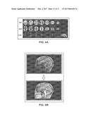 SYSTEM FOR PROCESSING MAGNETIC RESONANCE IMAGES USING AUTOMATIC SEGMENTING diagram and image