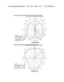 SINGLE SPACE WIRELESS PARKING WITH IMPROVED ANTENNA PLACEMENTS diagram and image