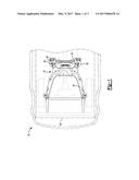 Composite Subframe Detachment diagram and image