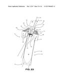 SUPPORT SYSTEM FOR AERODYNAMIC SKIRT ASSEMBLY AND METHOD OF INSTALLATION     THEREOF diagram and image