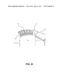 SUPPORT SYSTEM FOR AERODYNAMIC SKIRT ASSEMBLY AND METHOD OF INSTALLATION     THEREOF diagram and image