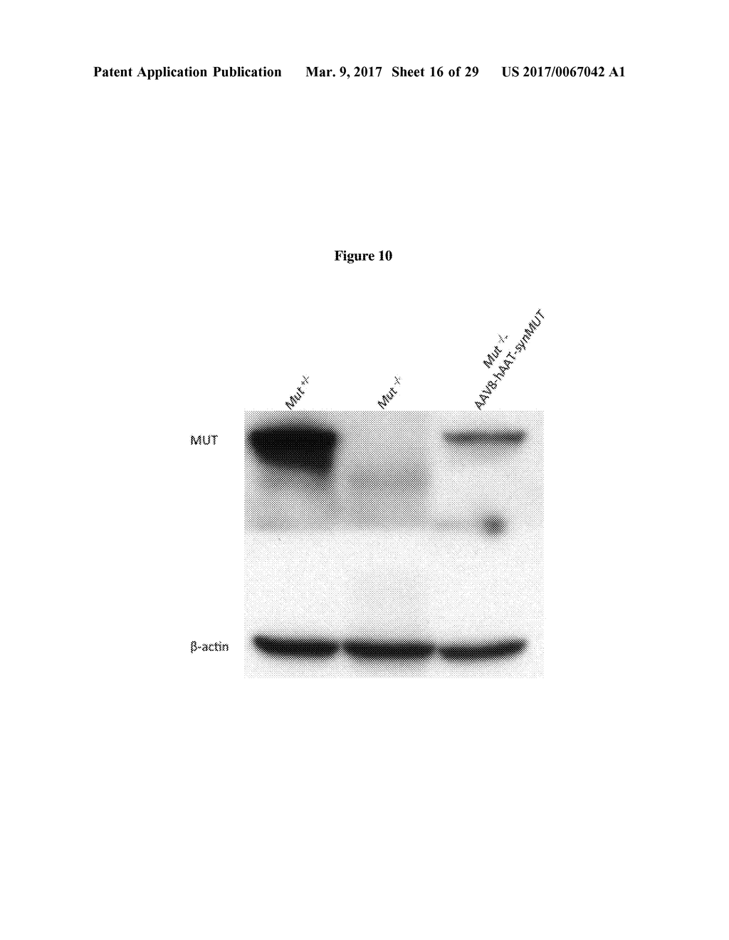 SYNTHETIC METHYLMALONYL-COA MUTASE TRANSGENE FOR THE TREATMENT OF MUT     CLASS METHYLMALONIC ACIDEMIA (MMA) - diagram, schematic, and image 17