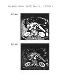 MEDICAL IMAGE PROCESSING APPARATUS, MEDICAL IMAGE PROCESSING METHOD, AND     MEDICAL IMAGE PROCESSING SYSTEM diagram and image