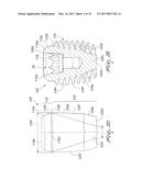 DENTAL IMPLANT FOR BONE COLLECTION AND DISTRIBUTION diagram and image