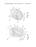 DENTAL IMPLANT FOR BONE COLLECTION AND DISTRIBUTION diagram and image