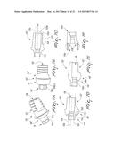 DENTAL IMPLANT FOR BONE COLLECTION AND DISTRIBUTION diagram and image