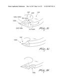 DENTAL IMPLANT FOR BONE COLLECTION AND DISTRIBUTION diagram and image