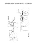 DENTAL IMPLANT FOR BONE COLLECTION AND DISTRIBUTION diagram and image