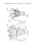 DENTAL IMPLANT FOR BONE COLLECTION AND DISTRIBUTION diagram and image