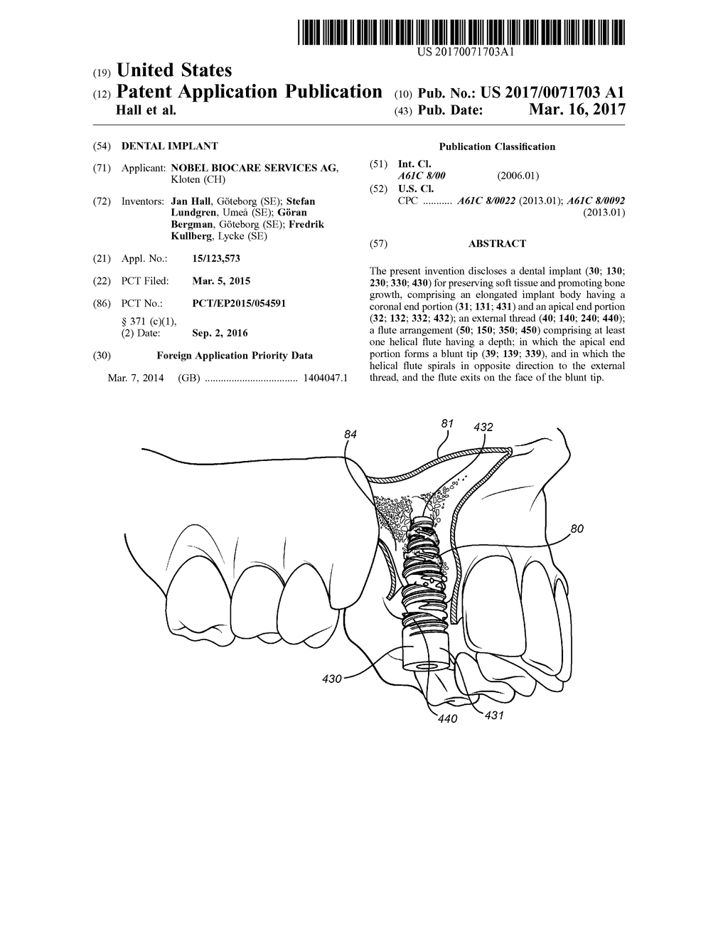 DENTAL IMPLANT - diagram, schematic, and image 01