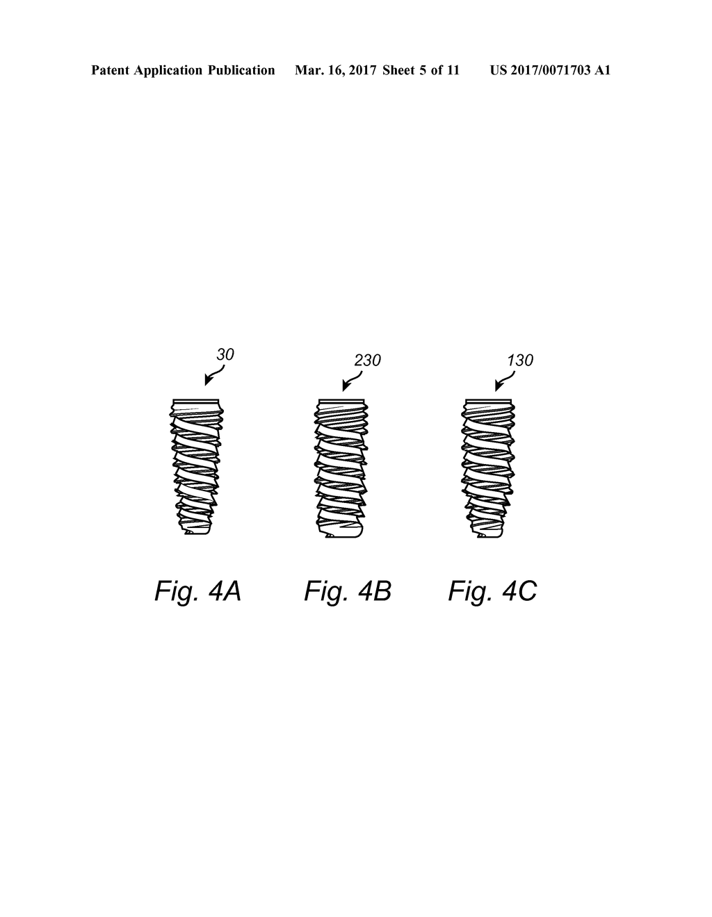 DENTAL IMPLANT - diagram, schematic, and image 06