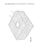 HYDRO-MECHANICAL AUTOGRAFTING TOOL AND METHOD OF USE diagram and image