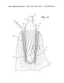 HYDRO-MECHANICAL AUTOGRAFTING TOOL AND METHOD OF USE diagram and image