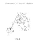 HEMODIALYSIS CATHETER SLEEVE diagram and image