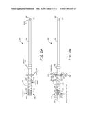 HEMODIALYSIS CATHETER SLEEVE diagram and image