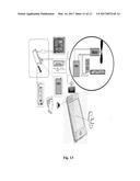 DEVICE AND METHOD FOR ADMINISTERING MEDICAMENTS TO THE BRAIN diagram and image