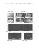 Regeneration of a Functional Pulmonary Vascular Bed diagram and image