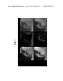 MOTION CORRECTED SIMULTANEOUSLY ACQUIRED MULTIPLE CONTRAST CORONARY MRI     SYSTEMS AND METHODS diagram and image