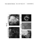 MOTION CORRECTED SIMULTANEOUSLY ACQUIRED MULTIPLE CONTRAST CORONARY MRI     SYSTEMS AND METHODS diagram and image