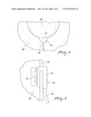 SOUND ACQUISITION DEVICE, PARTICULARLY FOR ACOUSTIC GUITARS diagram and image